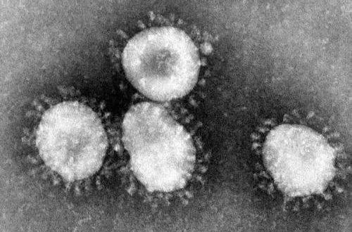 Photo: CDC/Dr. Fred Murphy – Public Domain
