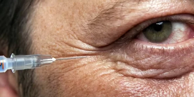 Botox