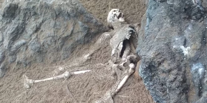 Antropología forense