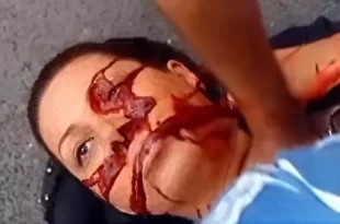 Neda